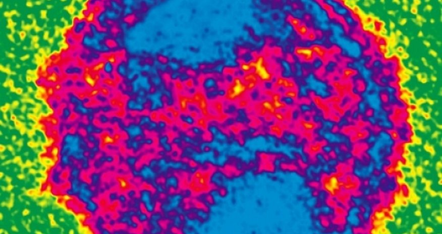 Kick and kill: is this the best new hope for an Aids cure?