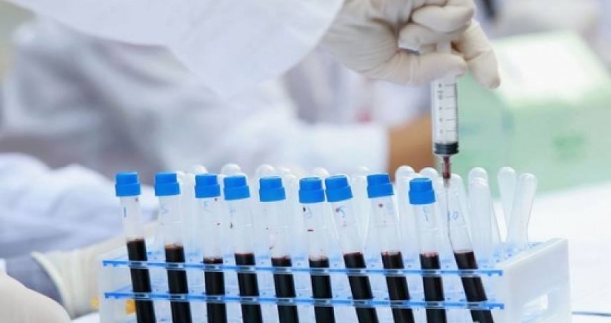 For the first time, scientists have literally edited HIV out of a human genome