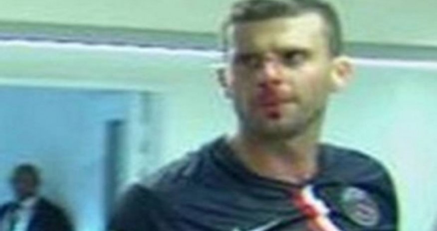 Thiago Motta head-butted