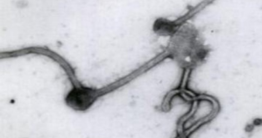 Several persons in Azerbaijan call “hotline” on suspicion of Ebola virus