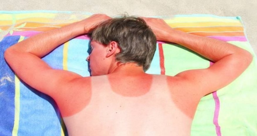 Why the sun is the skin’s frenemy?