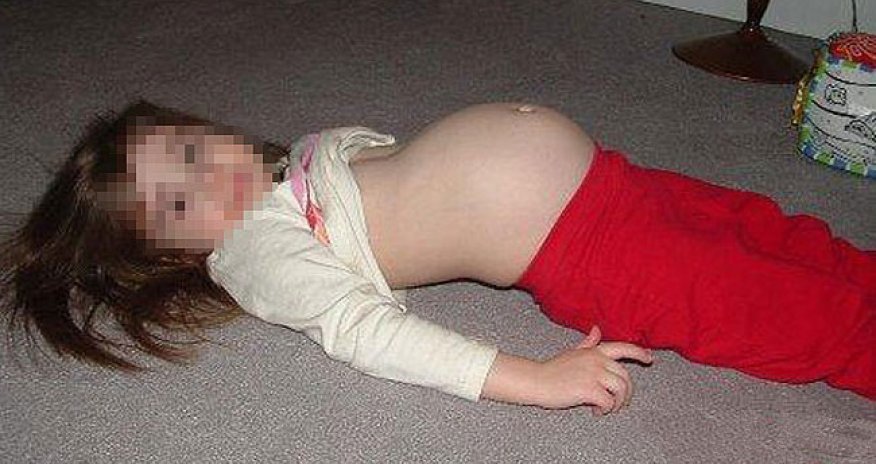 Mother allowed man to sleep with her daughter,11, and get her pregnant - PHOTO