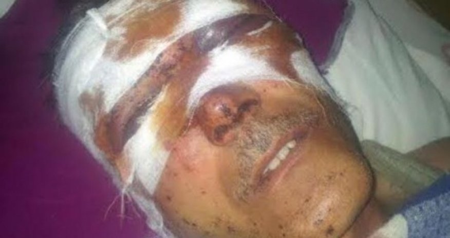 Beaten journalist of radio Liberty Ilgar Nasibov - PHOTOS