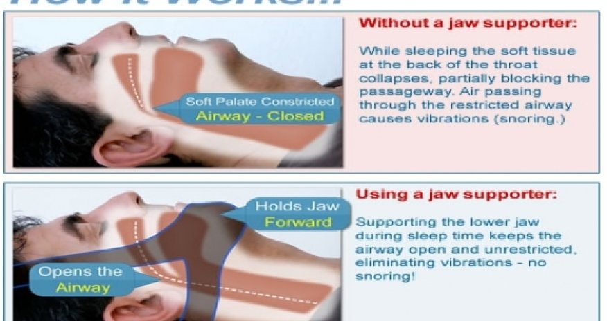 How to stop snoring and sleep well again