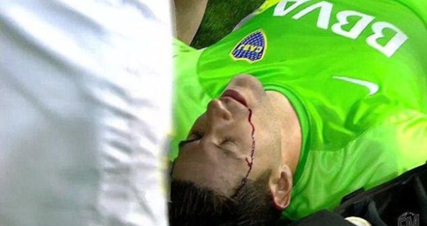 Goalkeeper struck by rock thrown by fans in shocking incident