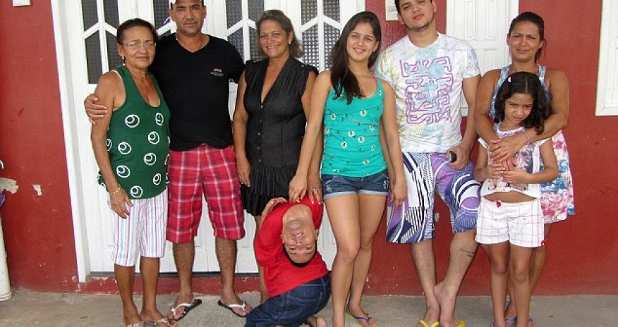 How baby born with the upside-down head becomes motivational speaker - PHOTO