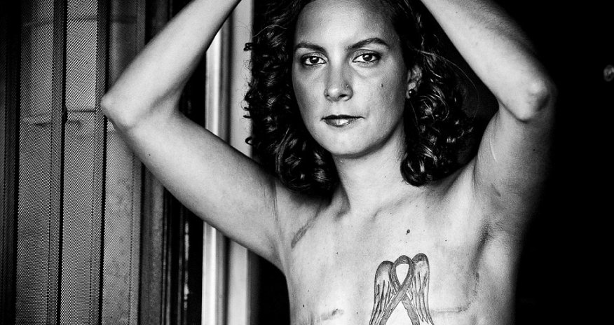 Scars of survival - PHOTO+VIDEO