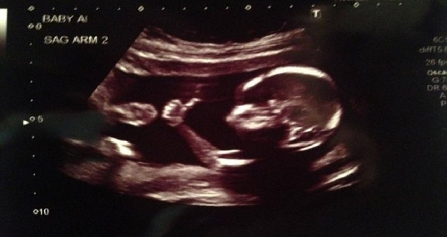 Is this the coolest baby ever?