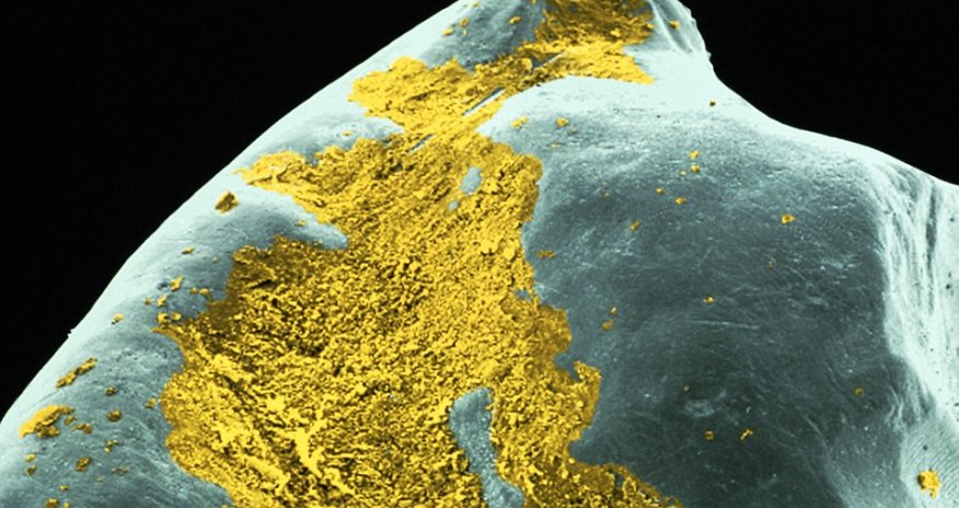 Gruesome 'alien invaders' are the bacteria lurking in the plaque on your TEETH - PHOTO