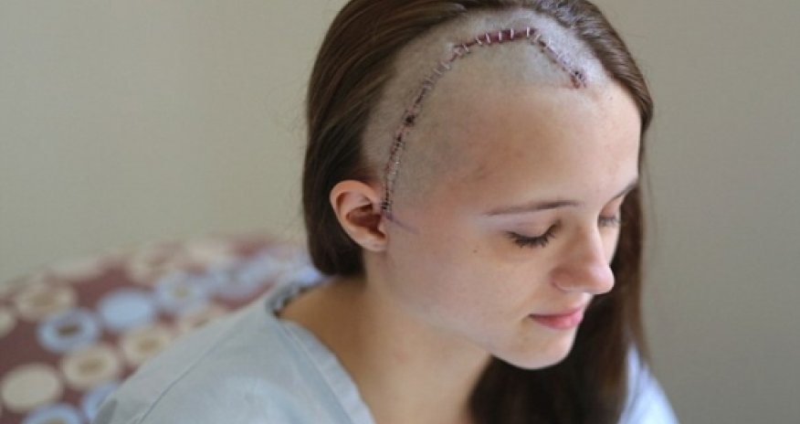 Assault victim reveals her horrific scars - VIDEO