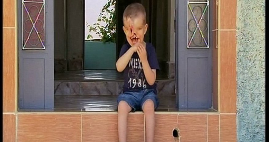 Born without a face - PHOTO+VIDEO