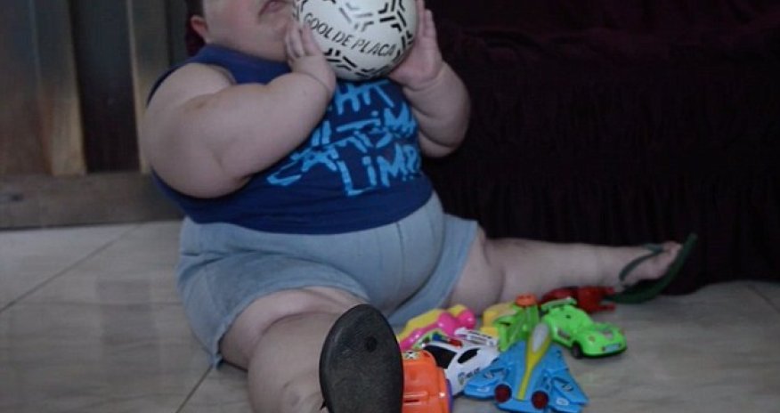 The 3-year-old boy who weighs 150lb due to syndrome - PHOTO