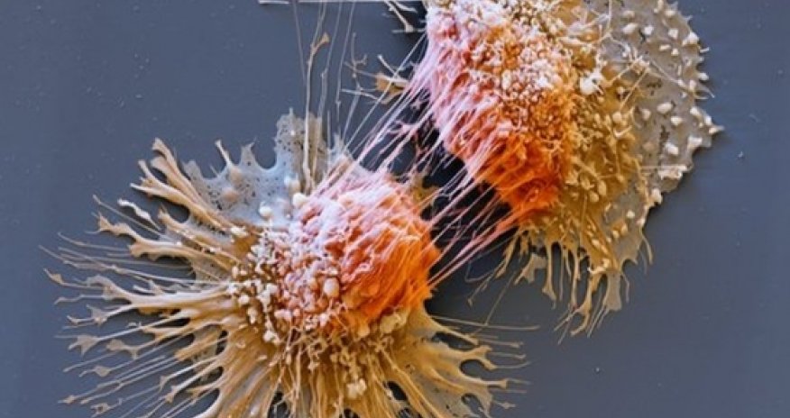 Cancer gene test 'would save lives'