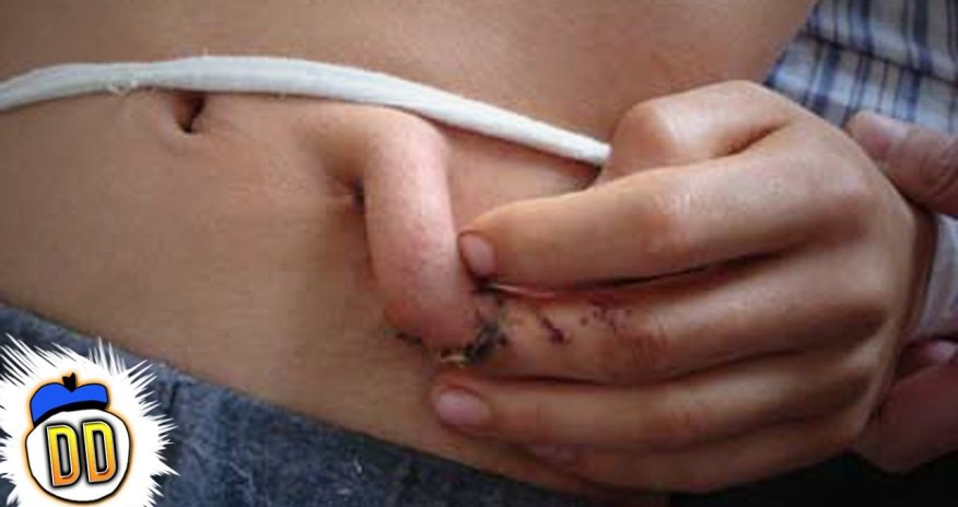 5 People with Extra Bodyparts - PHOTO+VIDEO