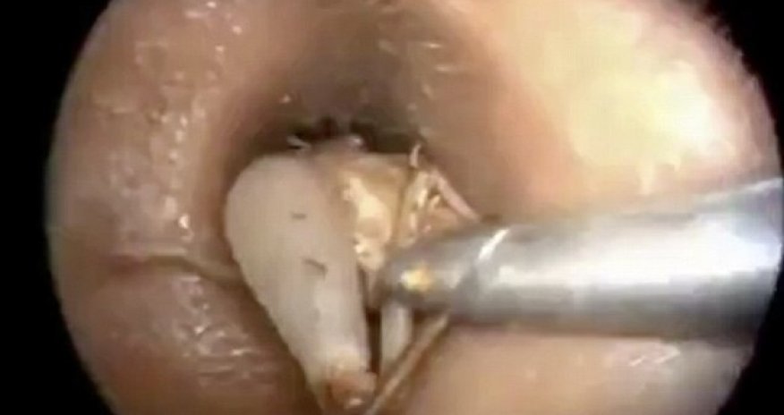 The ultimate ear wig! - PHOTO+VIDEO