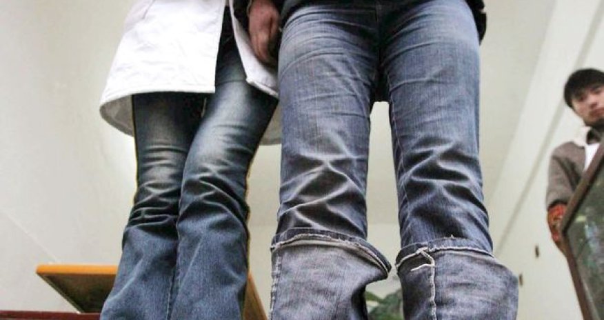 Miracle woman born with backwards feet - PHOTO