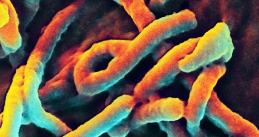 Ebola is 'entrenched' in West Africa