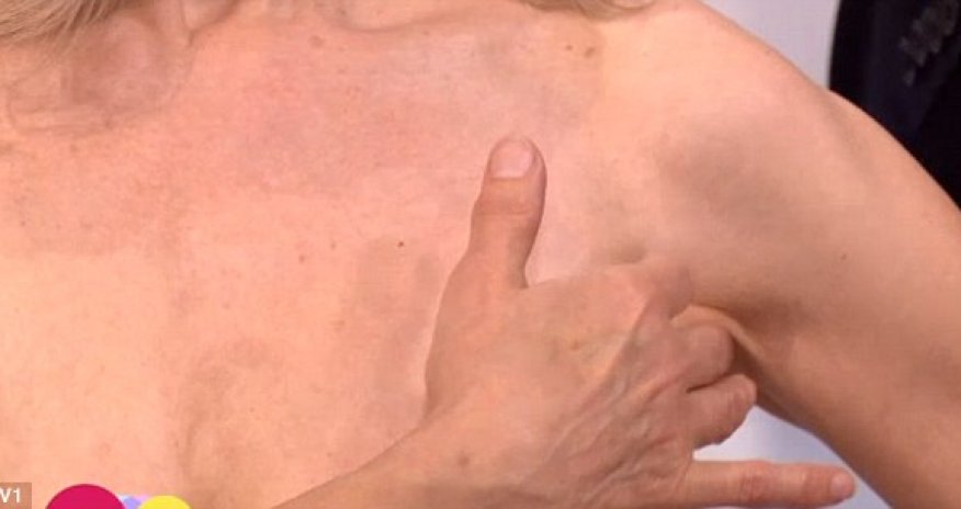 'Most women have no idea how to check their breasts for cancer' - VIDEO
