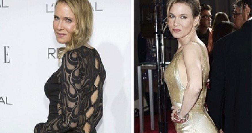 Renee Zellweger: my face looks different because I'm at peace