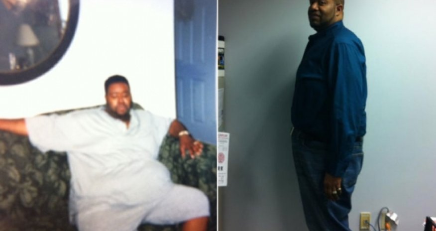 Artist Robert E. Jones to lose 218 pounds