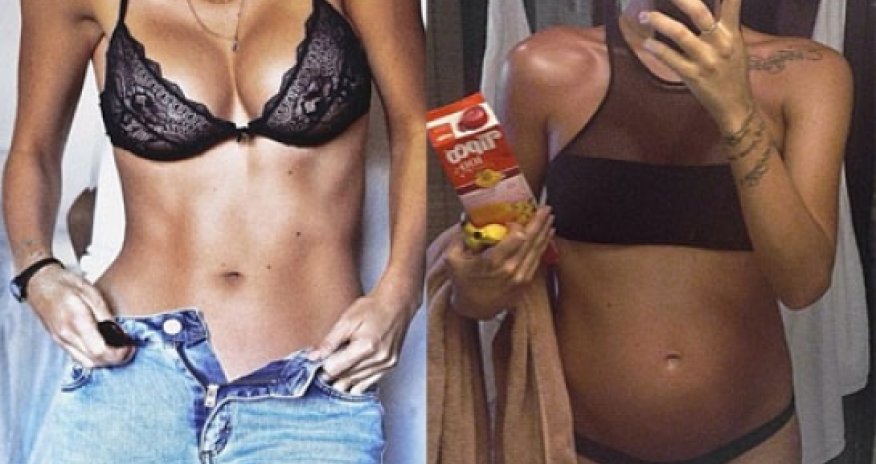 Pregnant woman, 25, branded 'irresponsible' for promoting banana diet