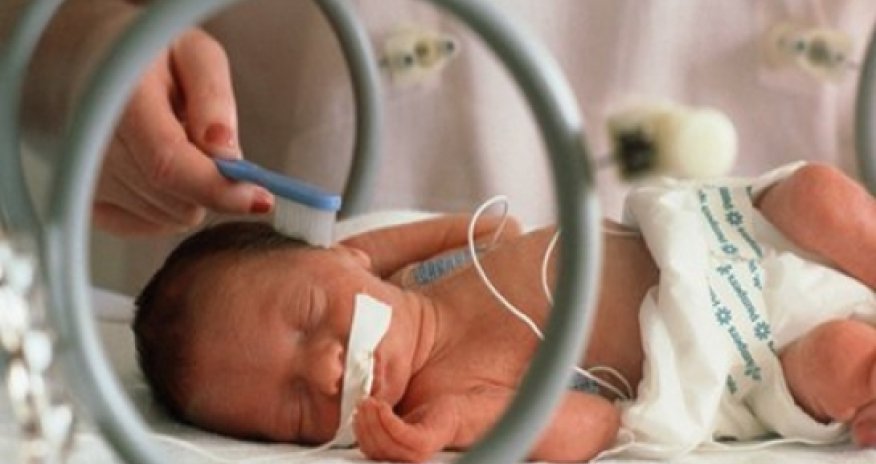 'Kangaroo care' key for premature babies