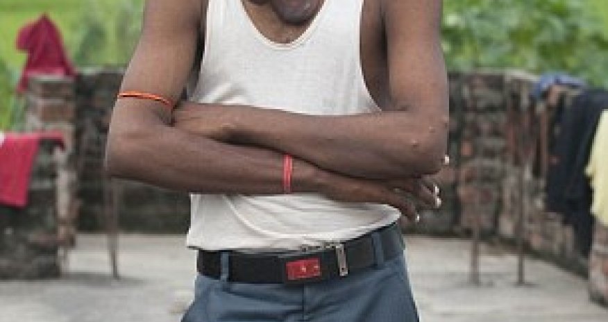 Indian man with huge facial tumour undergoes surgery - PHOTO+VIDEO