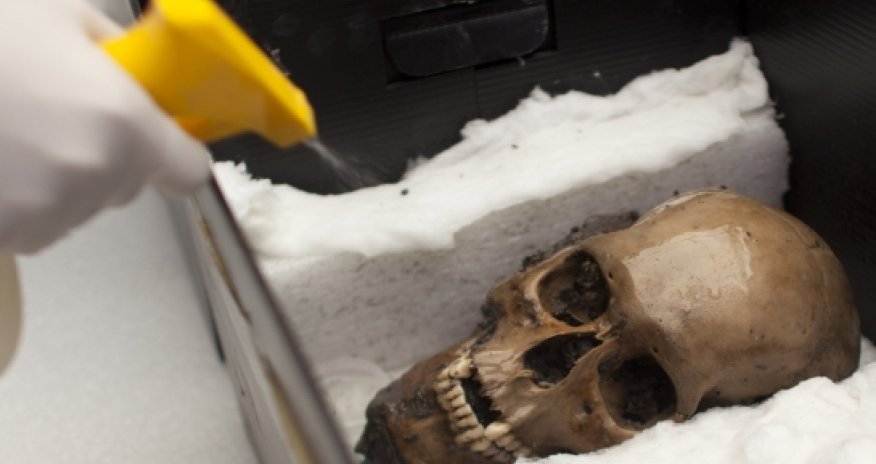 Deformed skull from dark ages unearthed in France