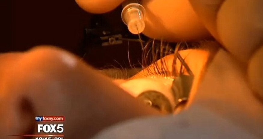 Woman gets platinum jewelry implanted in her optic membrane - PHOTO