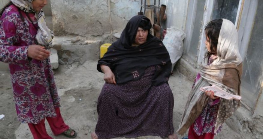 Victim of acid attack shows her terrible scars - PHOTO