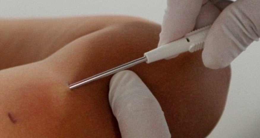 Could this be a dieter's best friend?