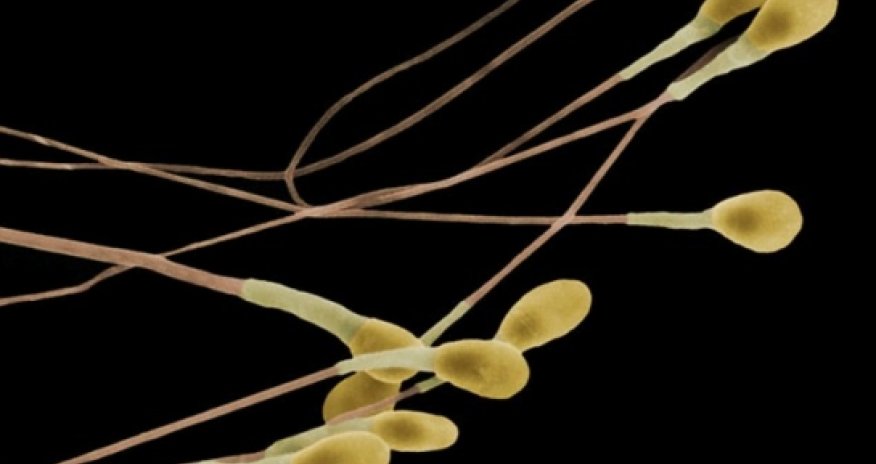 Male pill keeps sperm 'in storage' during sex - BBC