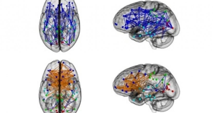 Men and women's brains are 'wired differently'