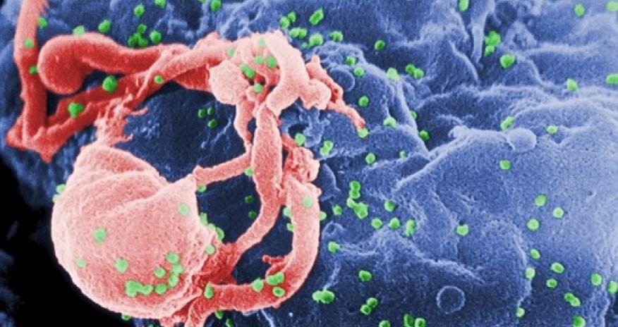 Scientists discover radiation 'bomb' that could wipe out HIV