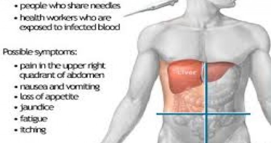 FDA approves faster, easier treatment for hepatitis C