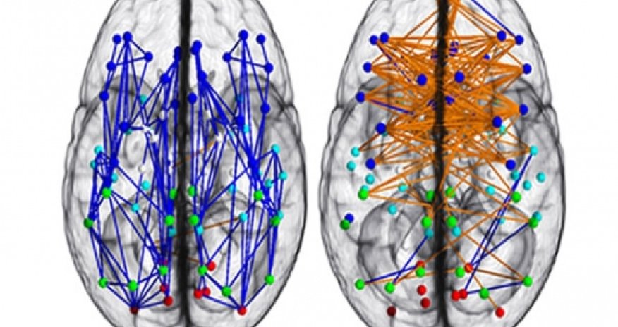 Sex and brains: Men and women are different