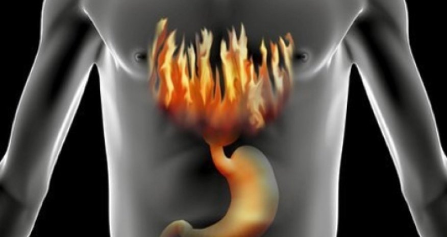 Ulcer pills linked to B12 deficiency