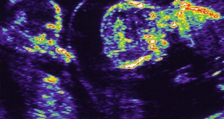 Exam grades 'more nature than nurture'