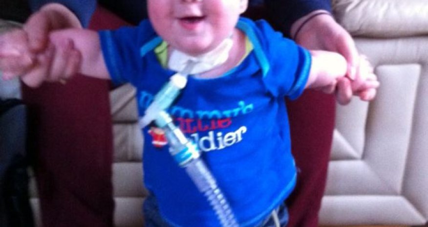 Boy with 12 fingers and 12 toes - PHOTO