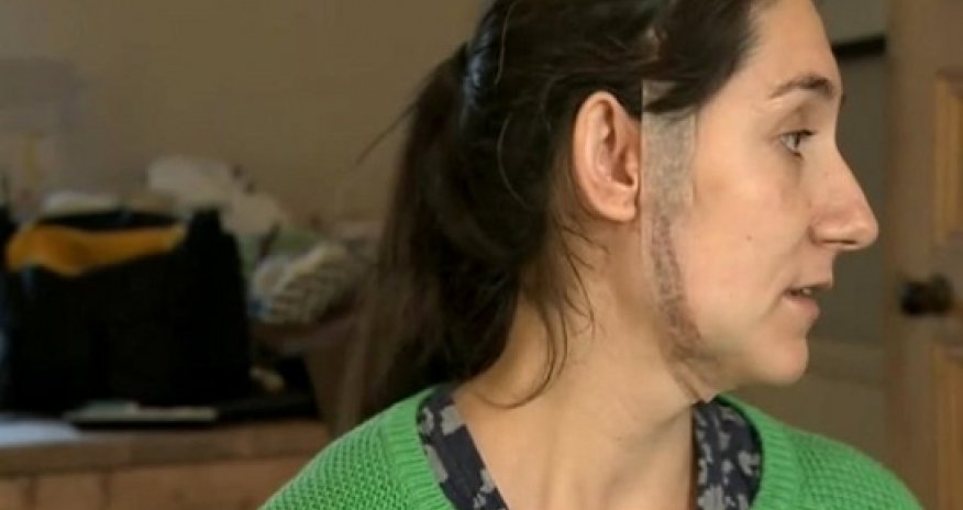 Heavily pregnant woman slashed across the face in ‘random’ attack