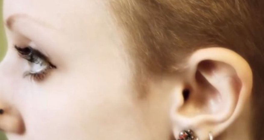 Woman has her ears cut to look more like an elf - PHOTO