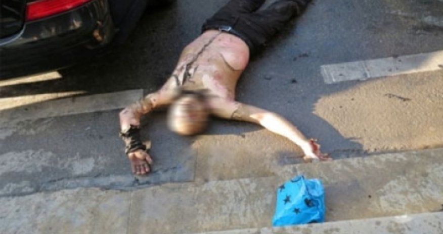 Health minister visits Azeri man who set himself alight