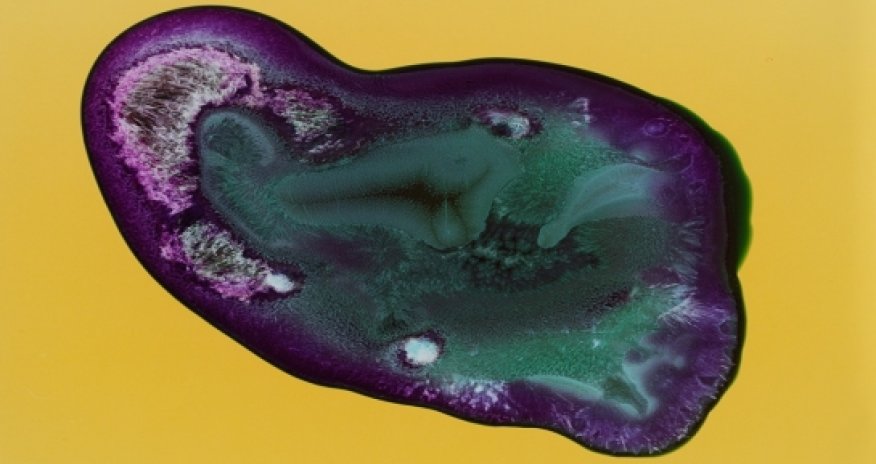 Astonishing photographs of drugs - PHOTO