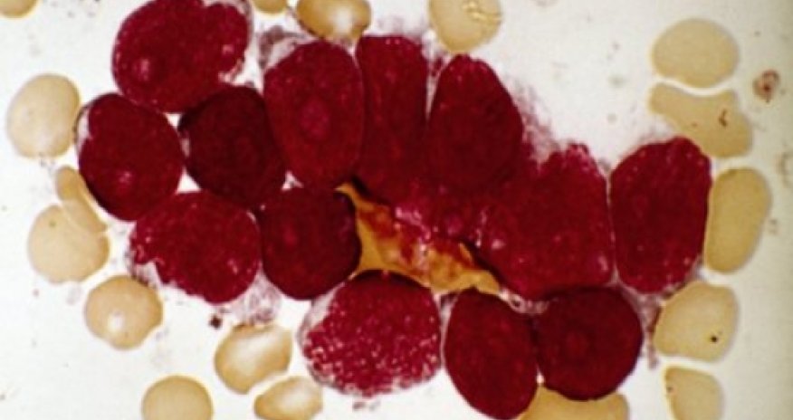 Antibody machinery can misfire and cause leukaemia