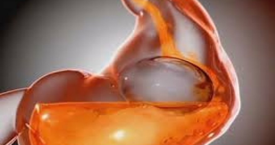 New balloon therapy to fight obesity