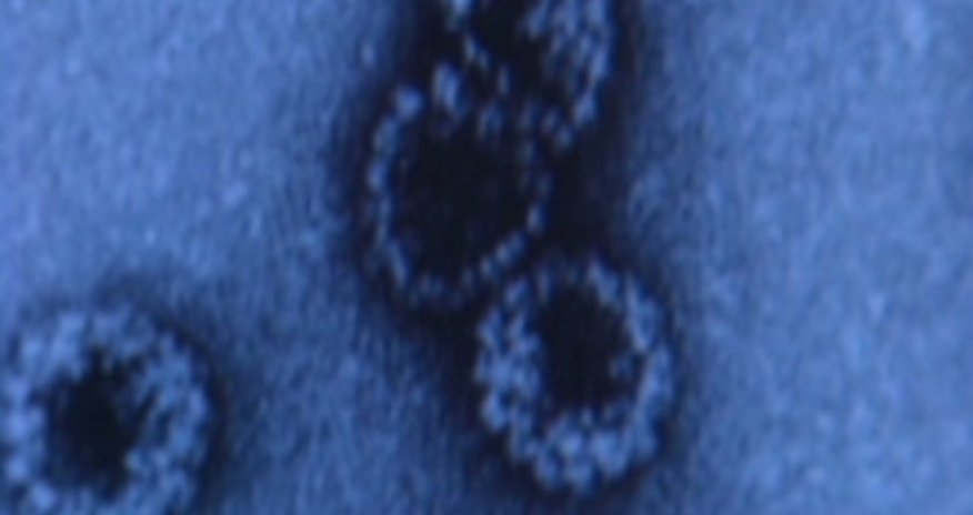 Imminent global cancer 'disaster' reflects aging