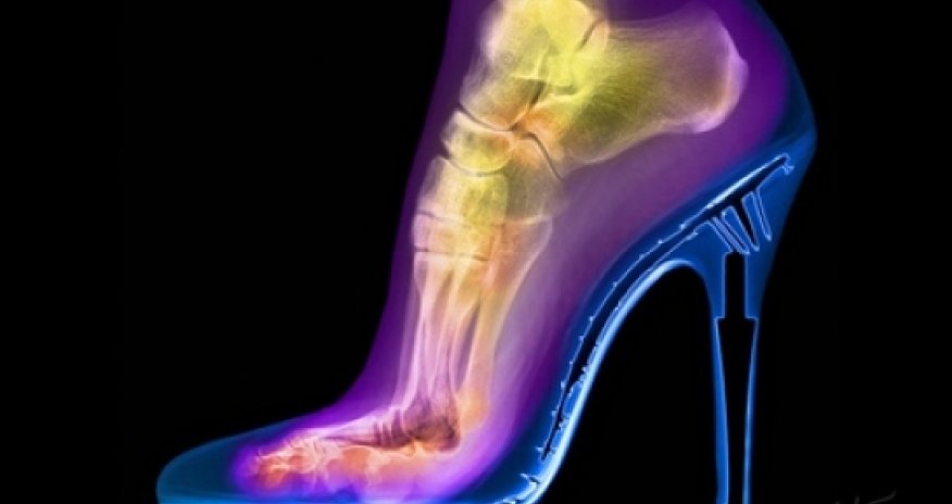X-ray photography that shows the world in a whole new light