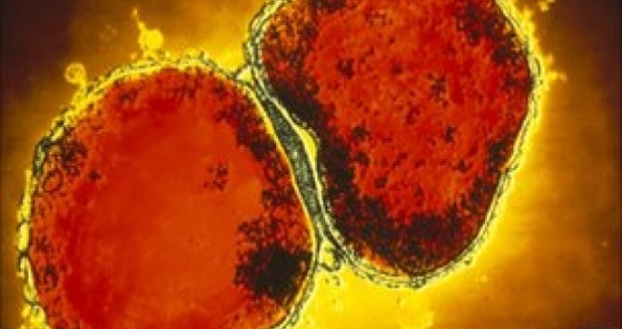 Lasers used in meningitis tests by Strathclyde University scientists