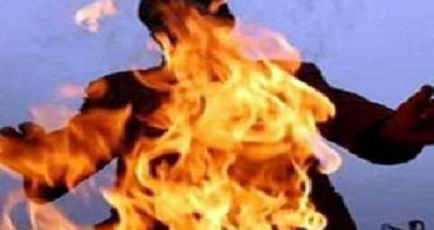 Nakhchivan resident sets himself on fire in protest against police