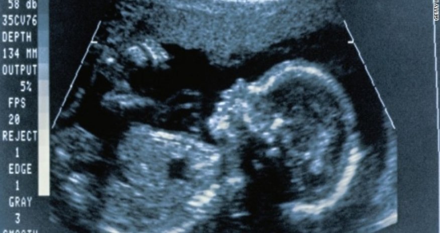 'Putting the next generation of brains in danger'